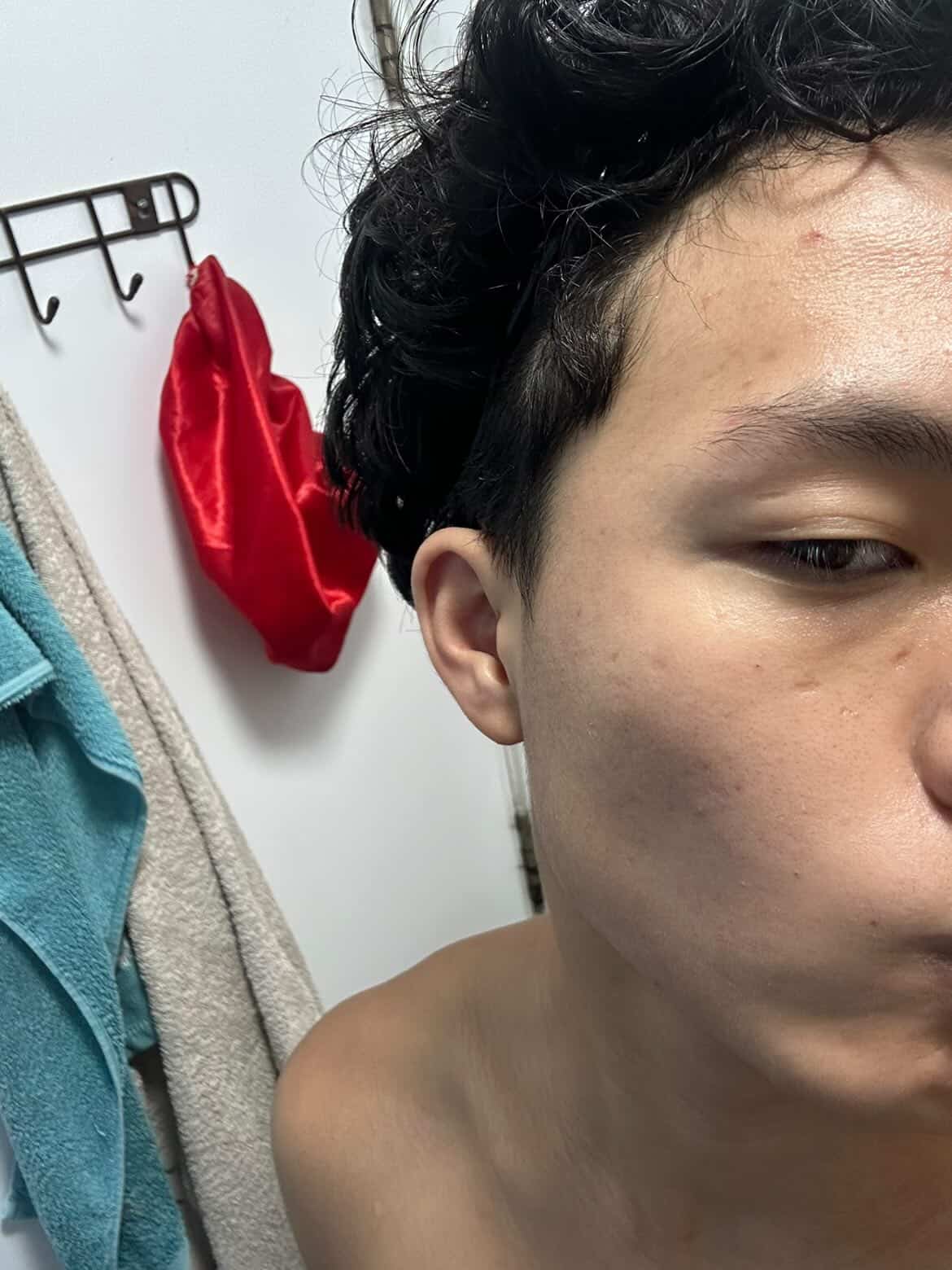 Jonathan Chen after