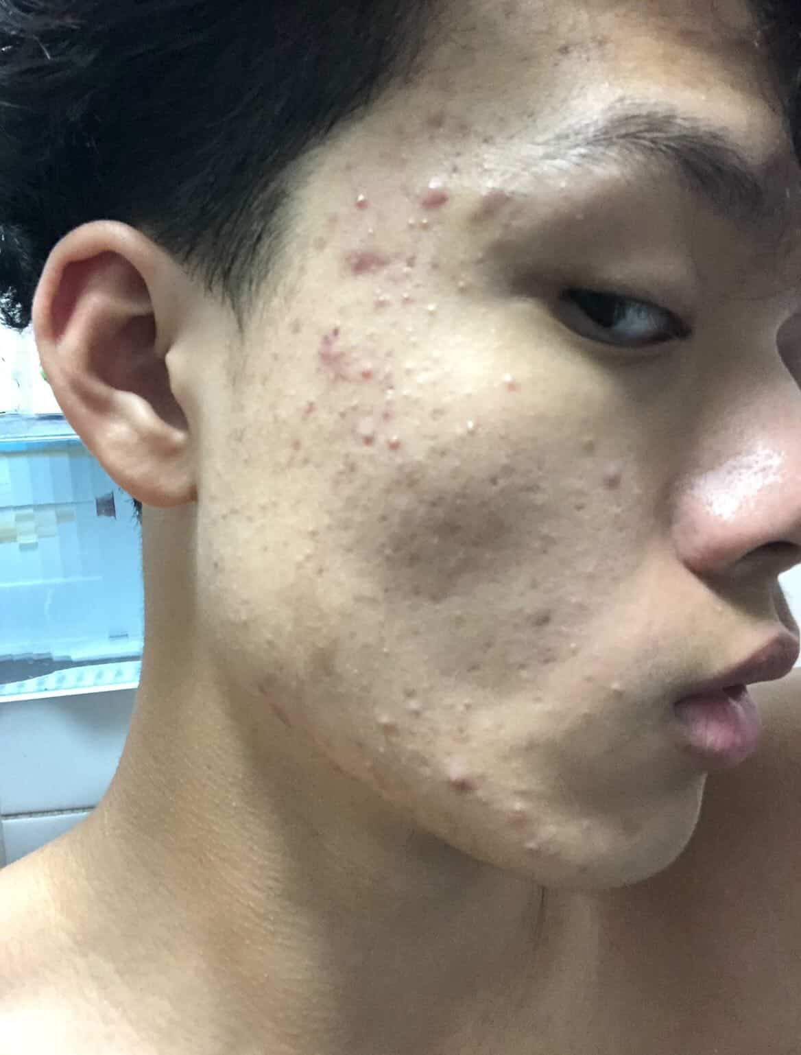 Jonathan Chen before